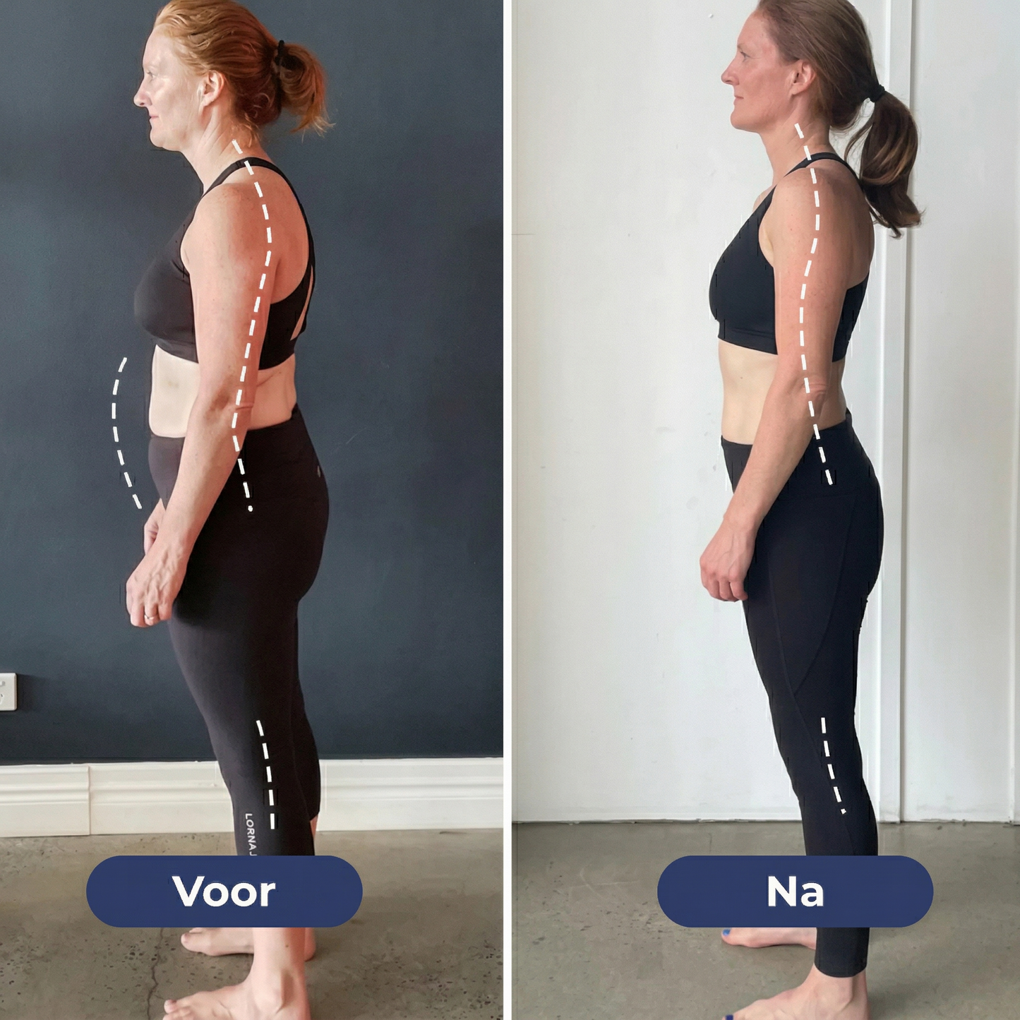 Reviora™ Rugbrace – Corrigeert je Houding